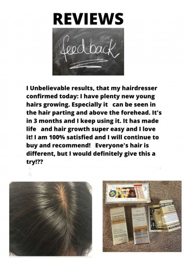 Are You Worried About Hair Loss? - Call Shawn Now!