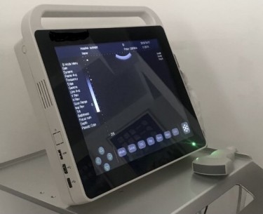 Portable Ultrasound Machine 15” Display Screen