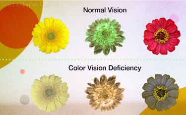 Understanding Color Blindness And Its Symptoms