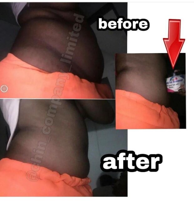 Belly Fat Remover