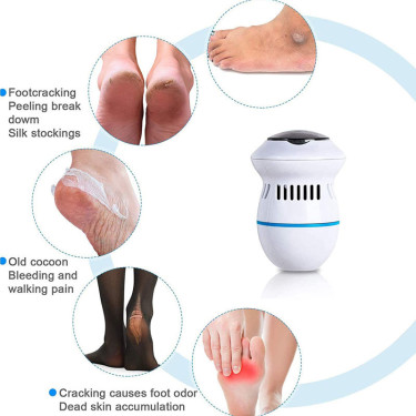 Electric Foot Scrubber | Black & Whitehead Remover